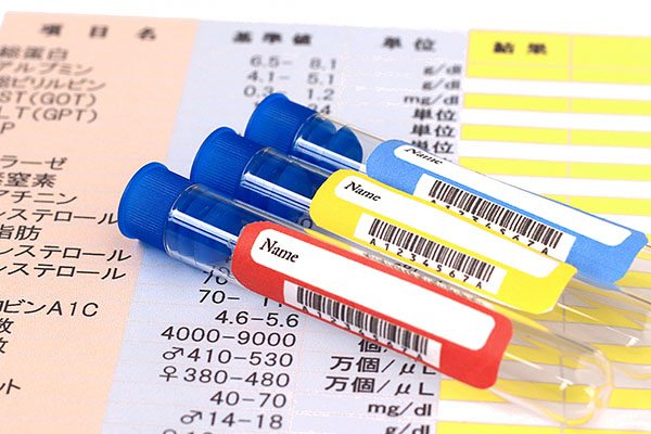 糖尿病網膜症のイメージ画像