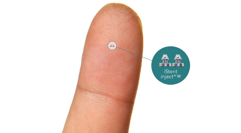 iStent inject® Wの大きさのイメージ