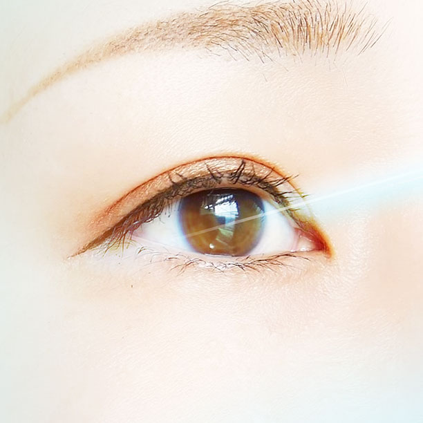 マイクロパルス閾値下レーザーのイメージ画像