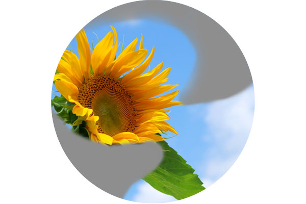 網膜静脈閉塞症のイメージ画像