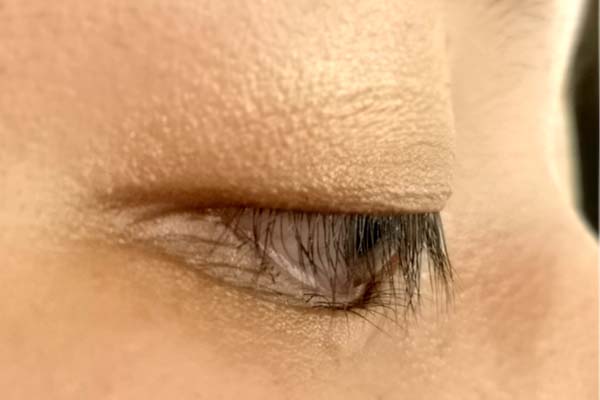 さかまつげのイメージ画像