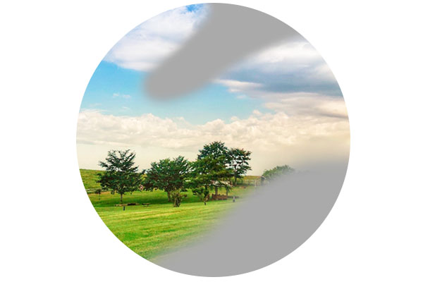 網膜剥離のイメージ画像